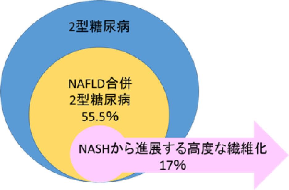 2型糖尿病におけるNASH/NAFLDの罹患率