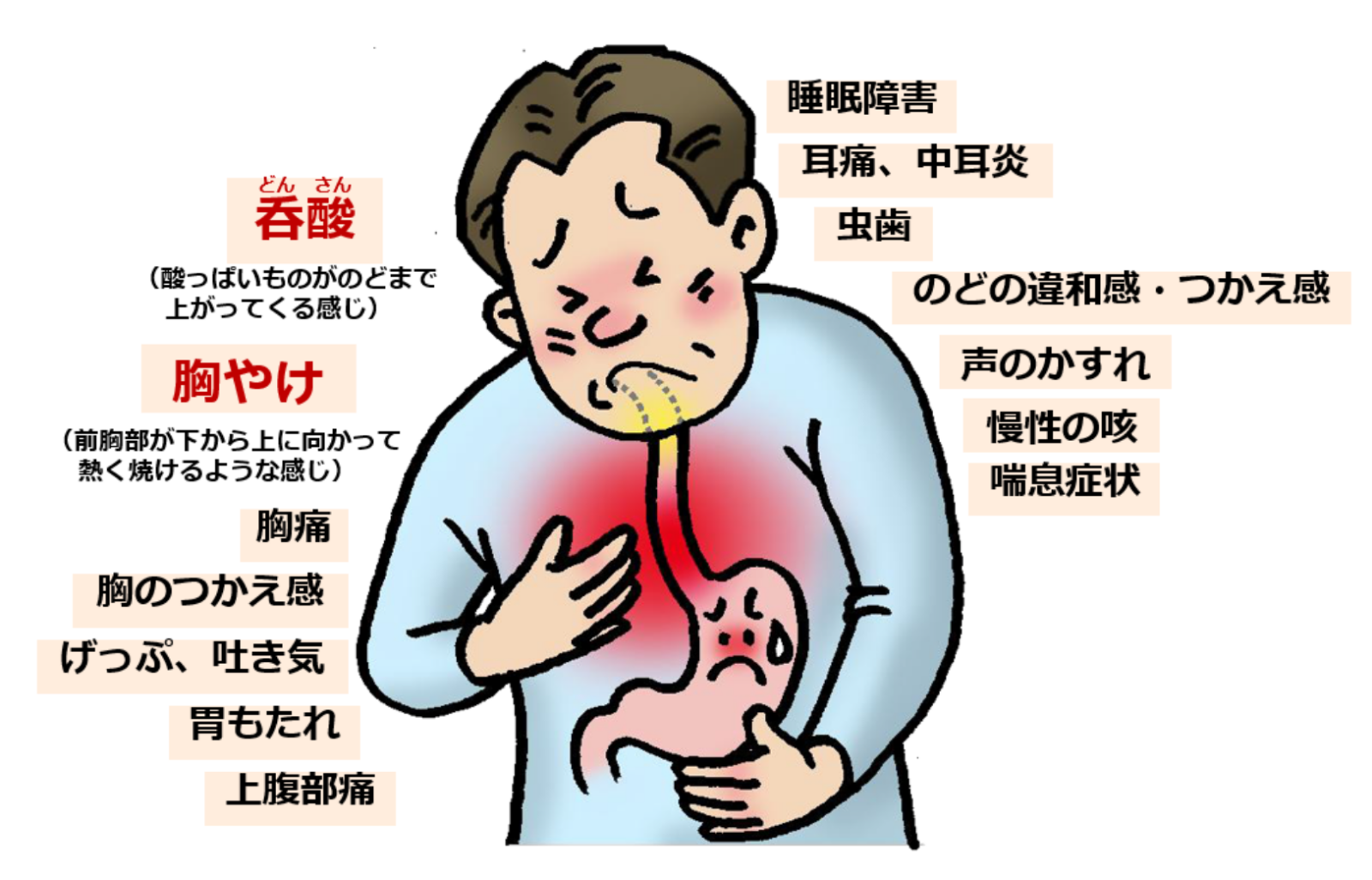 逆流性食道炎と不安症をどうやって克服しますか?