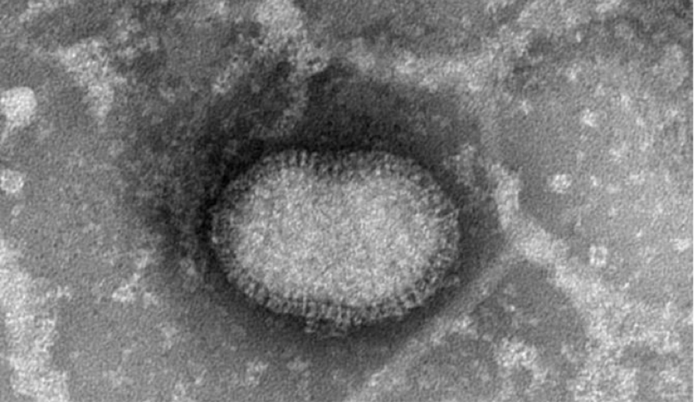 インフルエンザウィルスの電子顕微鏡写真